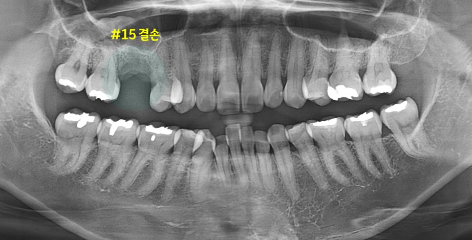 Treatment case image 1