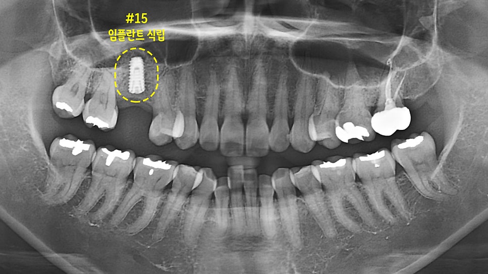 Treatment case image 3