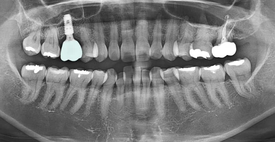 Treatment case image 5