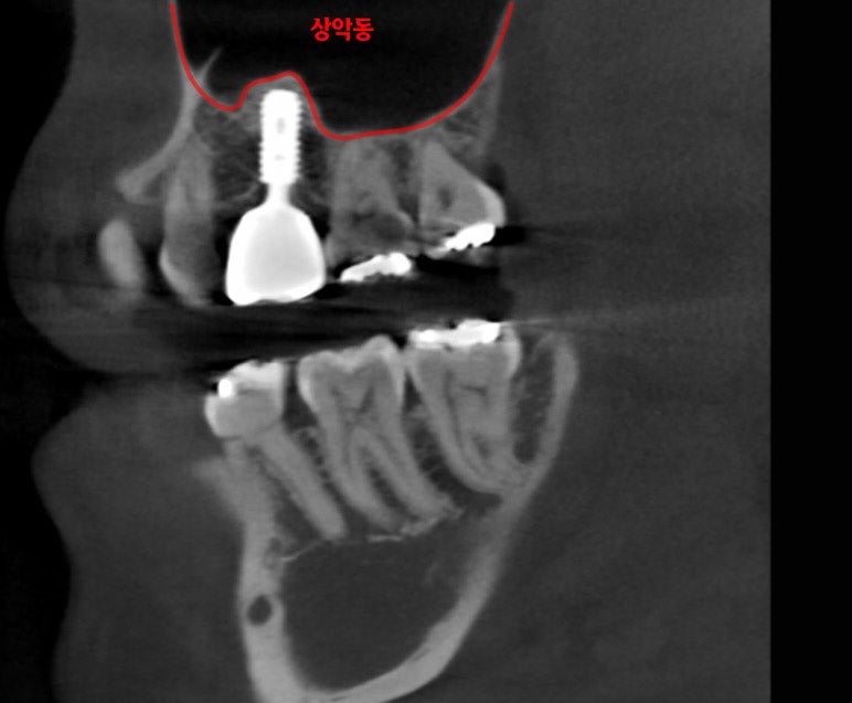 Treatment case image 6