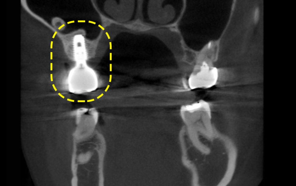 Treatment case image 7