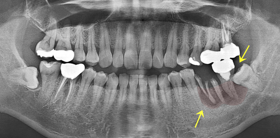 Treatment case image 1