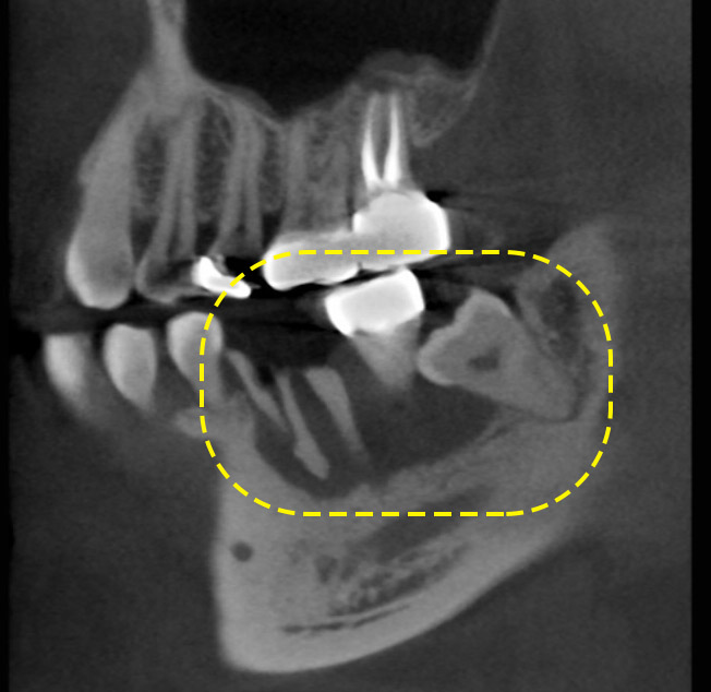 Treatment case image 2
