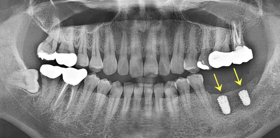 Treatment case image 5