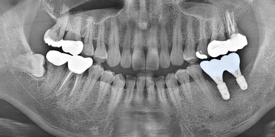 Treatment case image 6