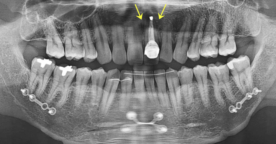 Treatment case image 1