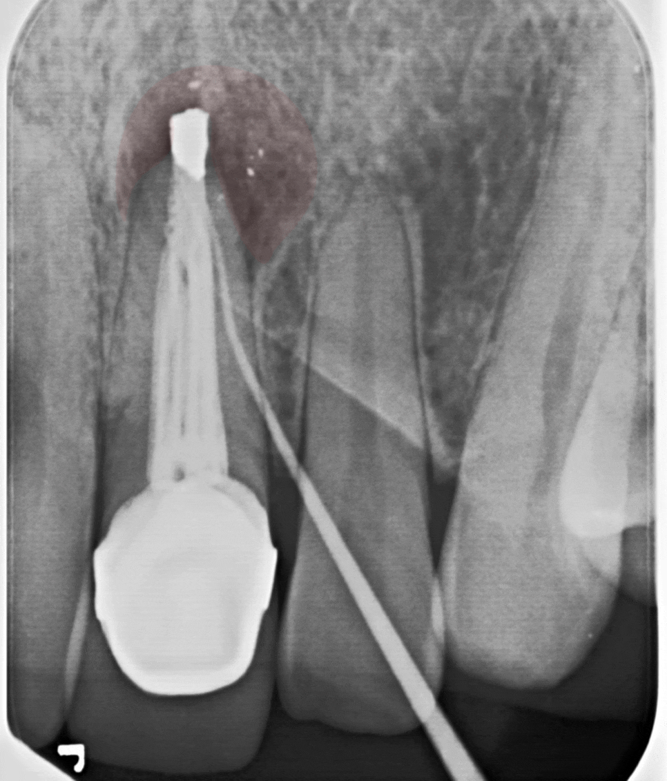 Treatment case image 2