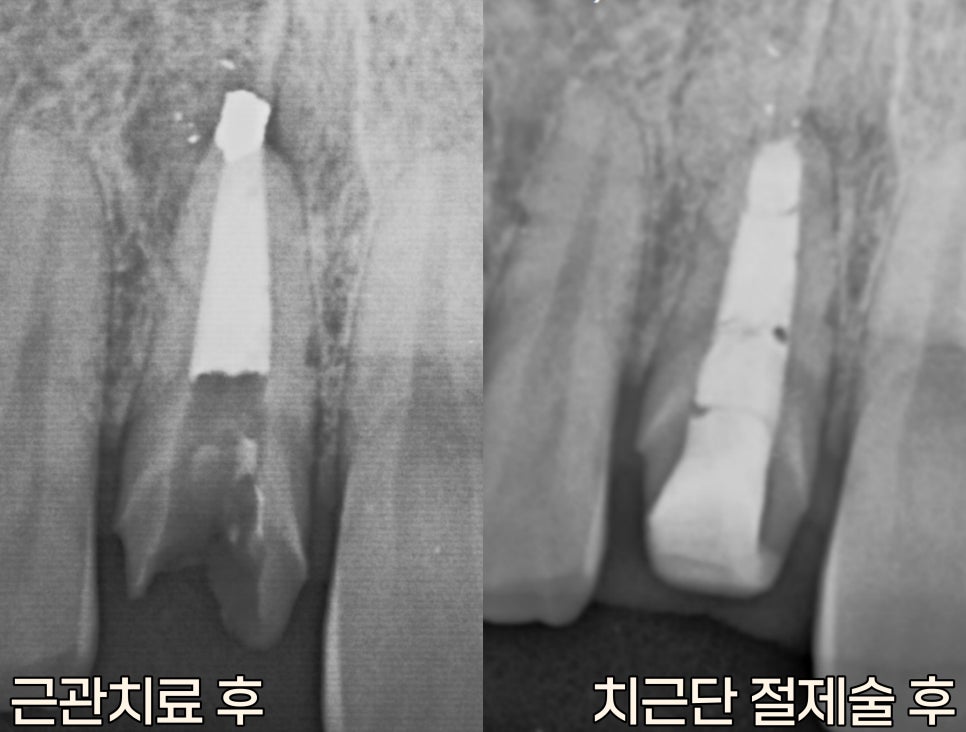 Treatment case image 3