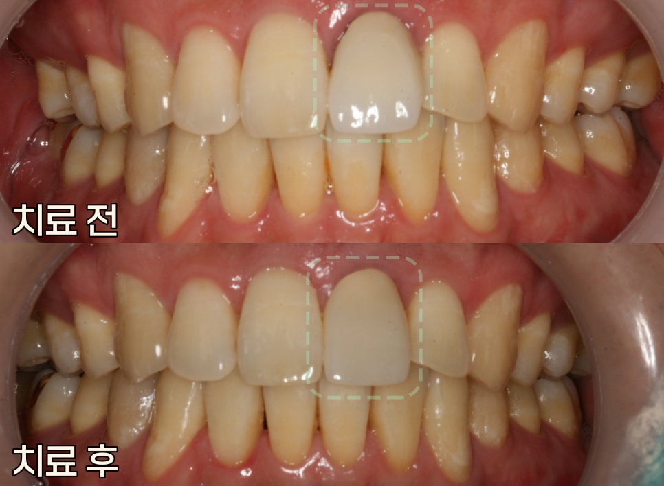 Treatment case image 4