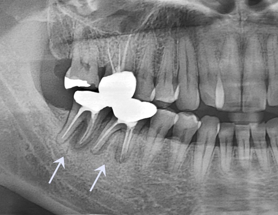 Treatment case image 1