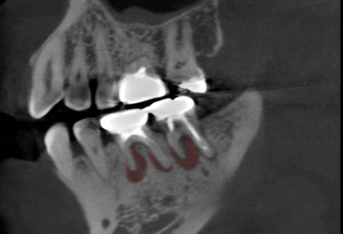 Treatment case image 2
