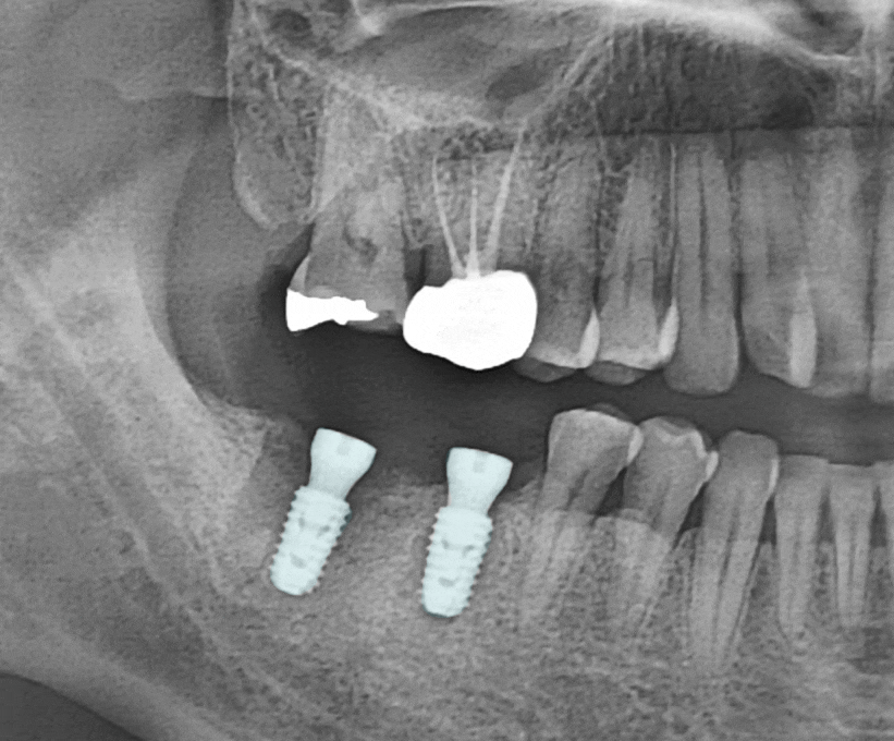 Treatment case image 5