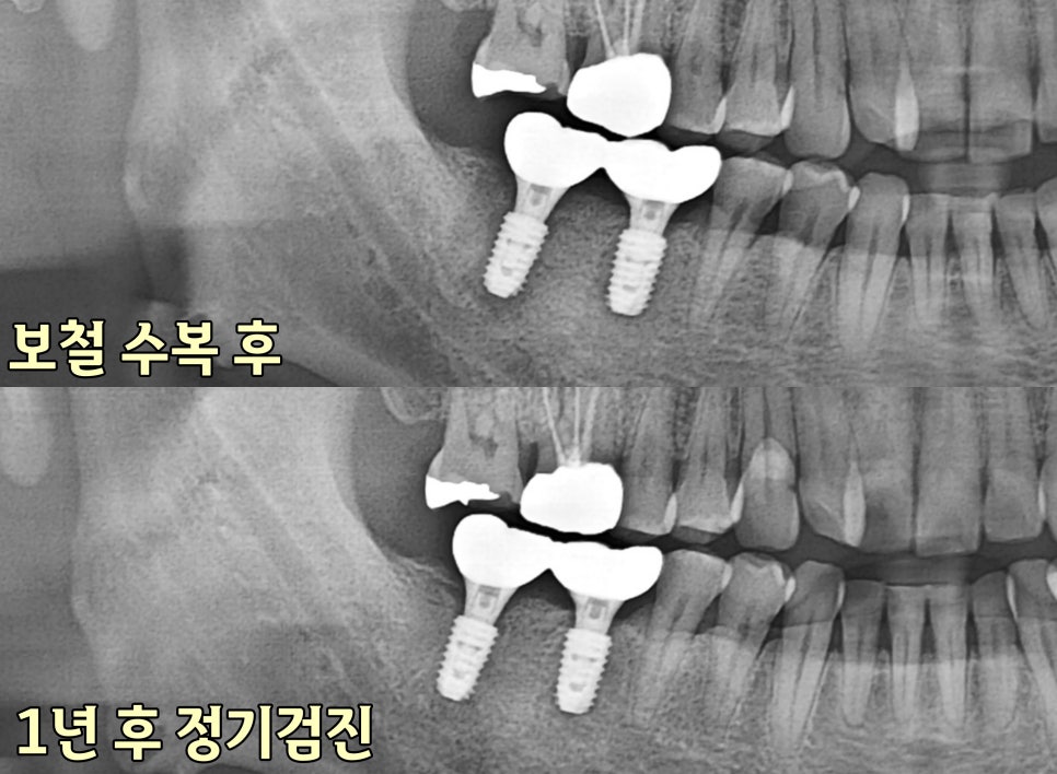 Treatment case image 4