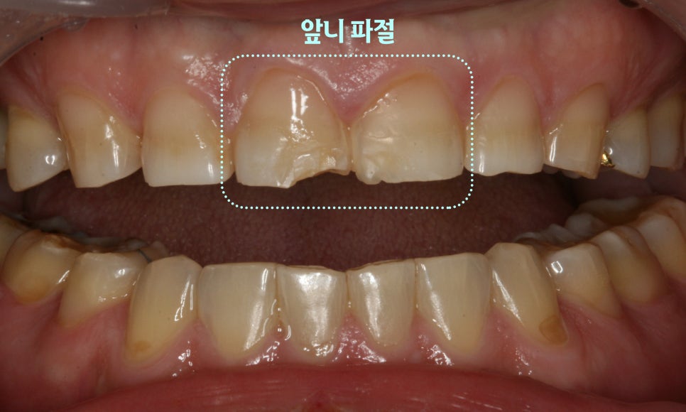 Treatment case image 1