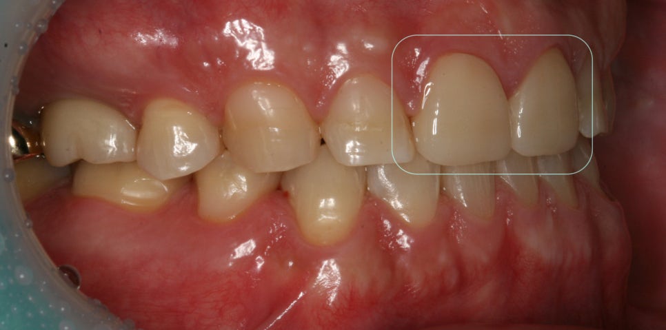 Treatment case image 4