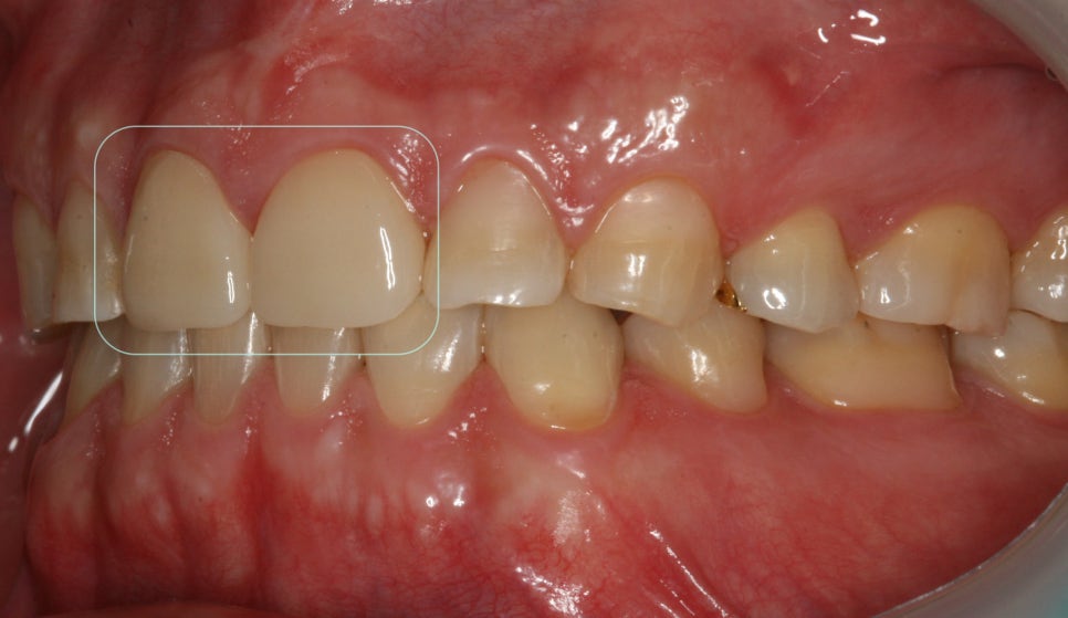 Treatment case image 5