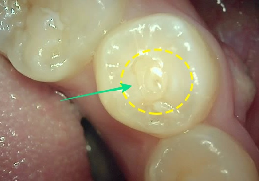 Treatment case image 1