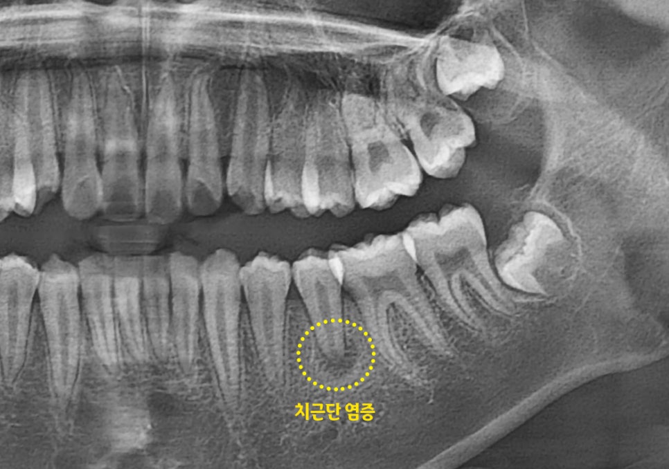 Treatment case image 2