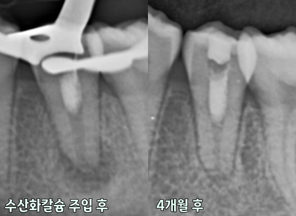 Treatment case image 5