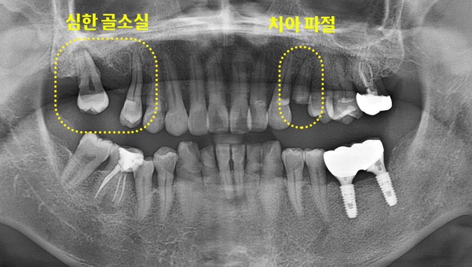 Treatment case image 1