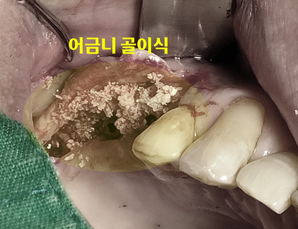 Treatment case image 3