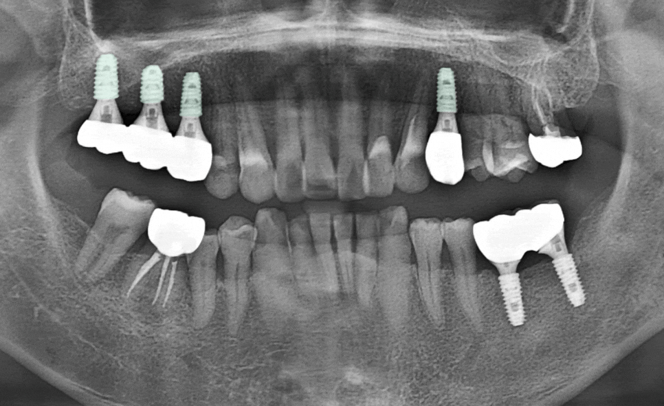 Treatment case image 4