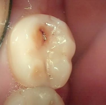 Treatment case image 1