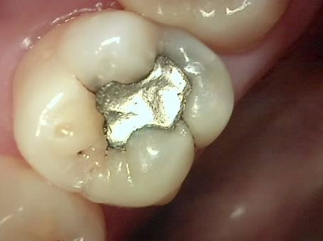 Treatment case image 3