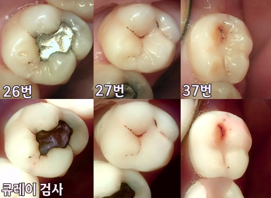 Treatment case image 4
