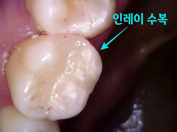 Treatment case image 7