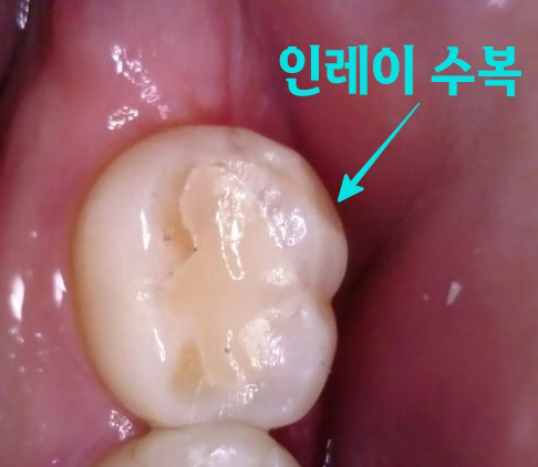 Treatment case image 8