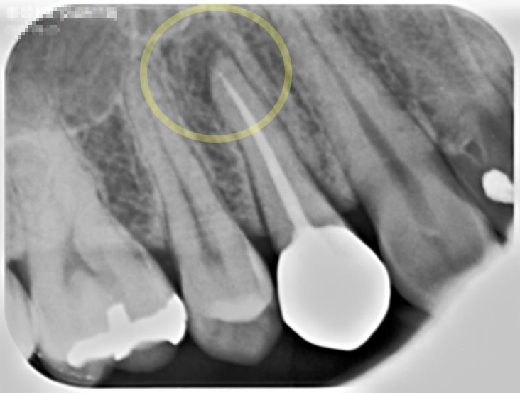 Treatment case image 1