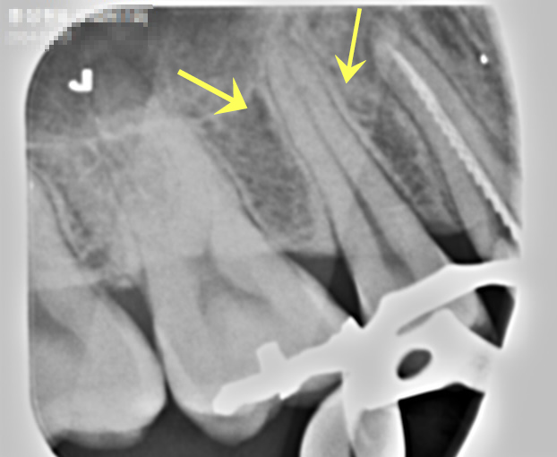 Treatment case image 2