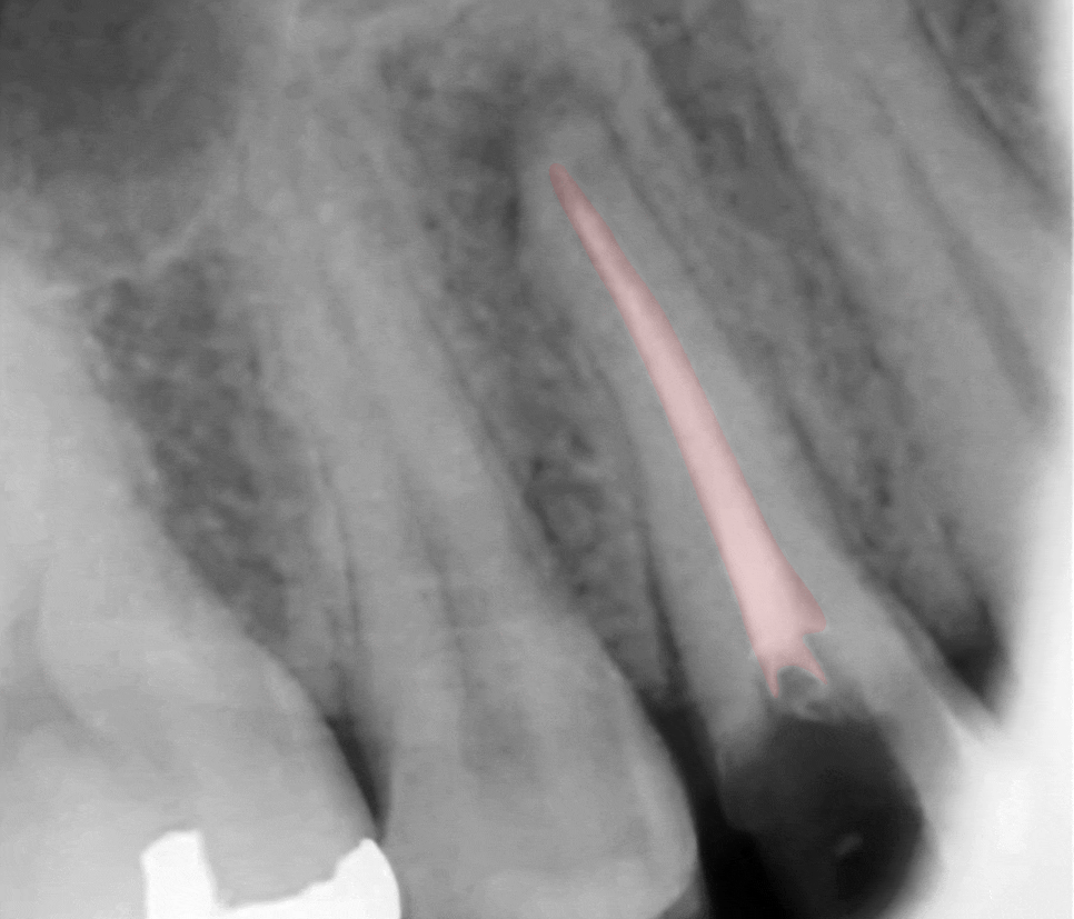 Treatment case image 5