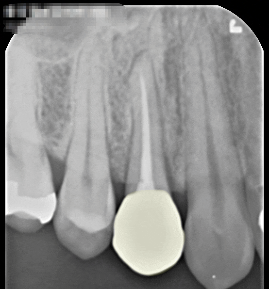 Treatment case image 7