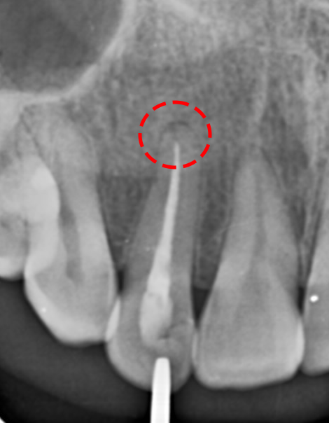 Treatment case image 1