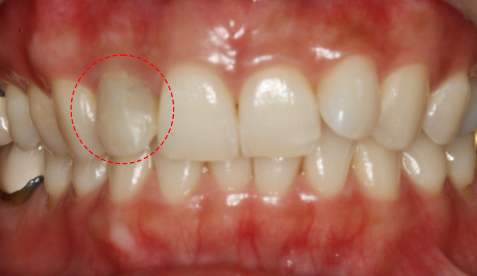 Treatment case image 2