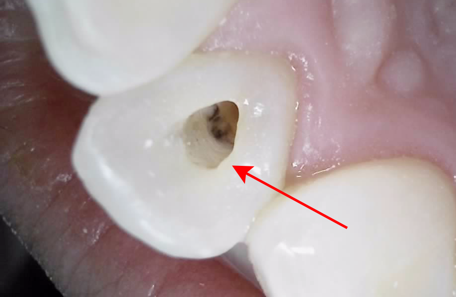 Treatment case image 5