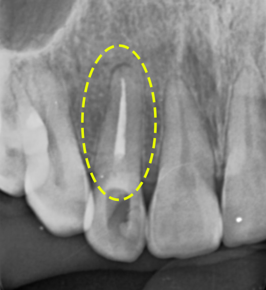 Treatment case image 6