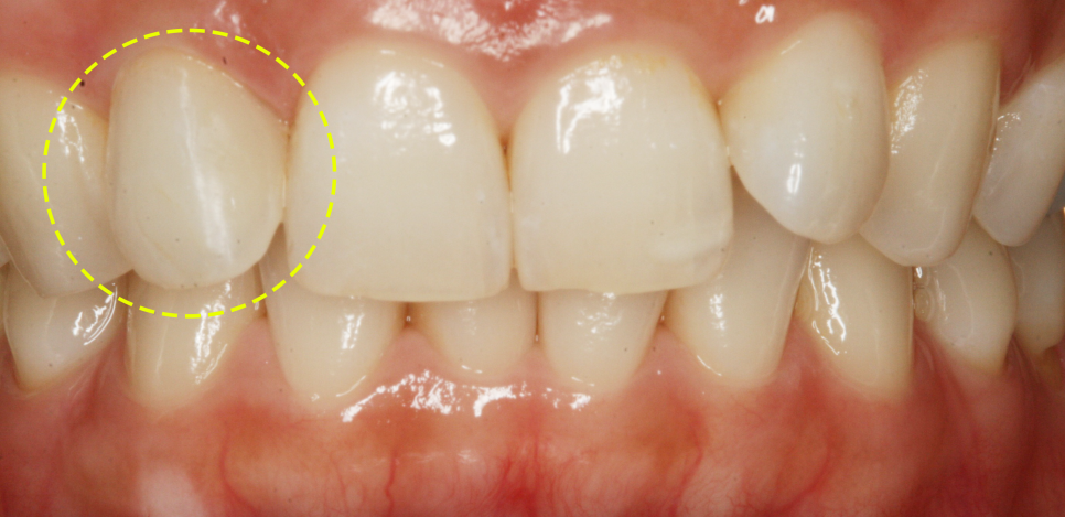 Treatment case image 9