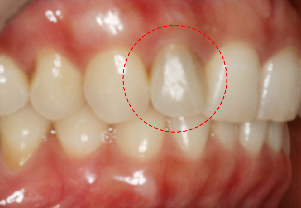 Treatment case image 10