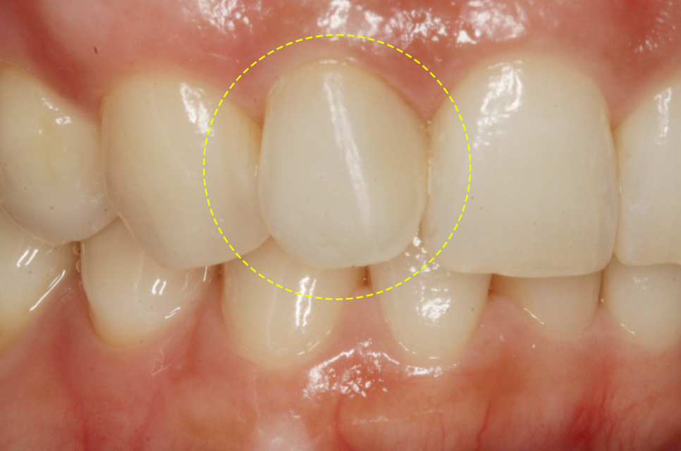 Treatment case image 11