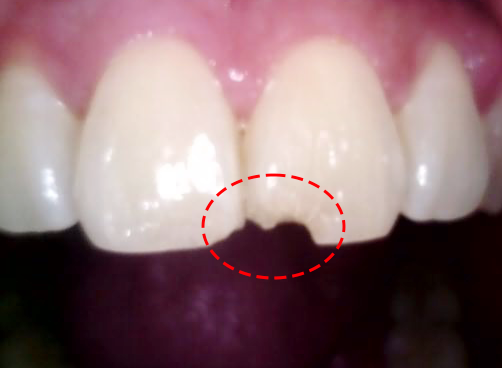 Treatment case image 1