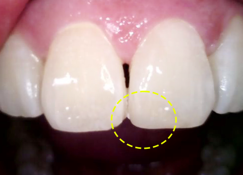 Treatment case image 3