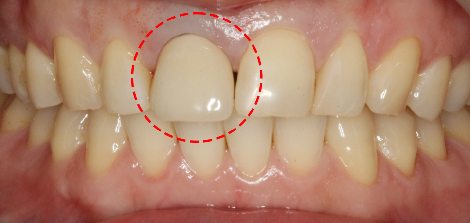 Treatment case image 1