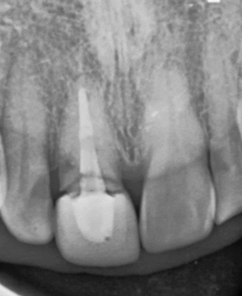 Treatment case image 2