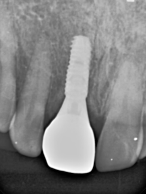 Treatment case image 5
