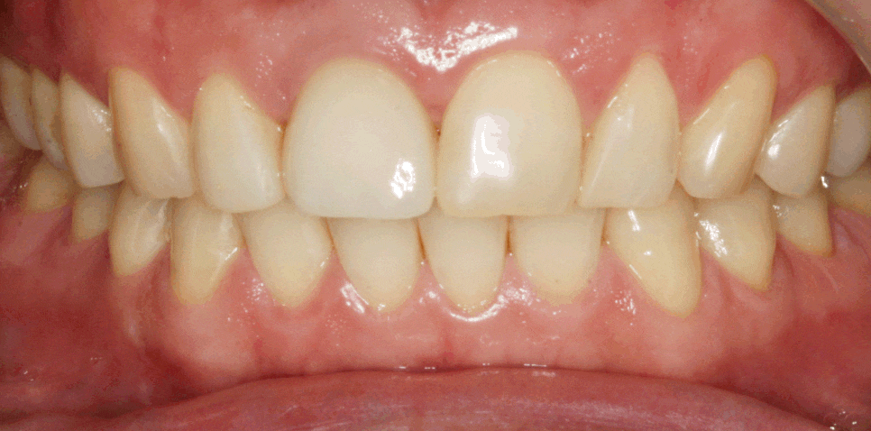 Treatment case image 6