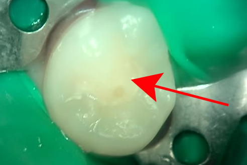 Treatment case image 1