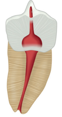 Treatment case image 2